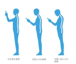 ストレートネック　スマホ