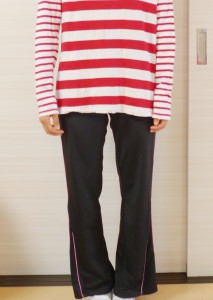 Ｏ脚矯正施術前